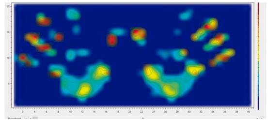 Sensing Mat柔性电子纺织品压力垫压力分布测量系统